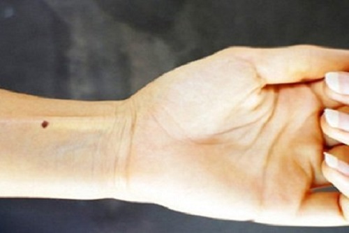 Bói 7 vị trí nốt ruồi ở cổ tay trái, phải chuẩn xác nhất!